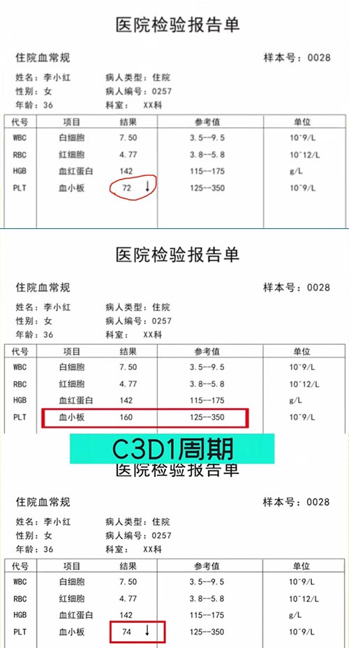 AE與研究藥物關(guān)系記錄不一致，如何處理？