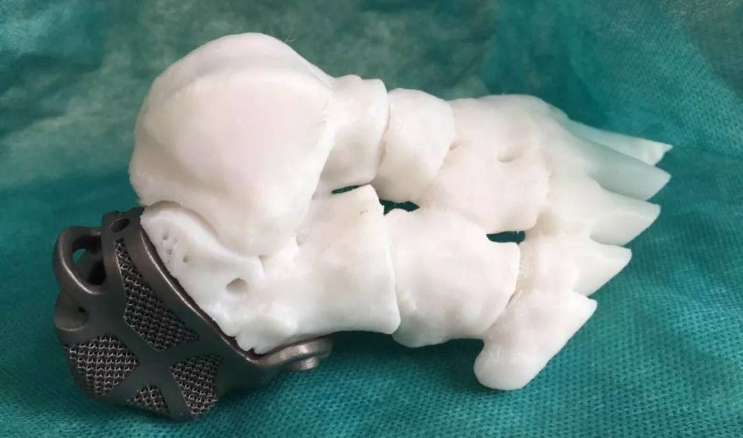 定制式個性化骨植入物等效性模型注冊技術審查指導原則（2020年第48號）(圖1)